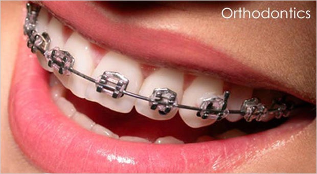 Orthodontic Treatment Doesn't Have To Be Visible!