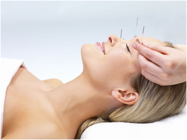 Everything You Need To Know About Acupuncture