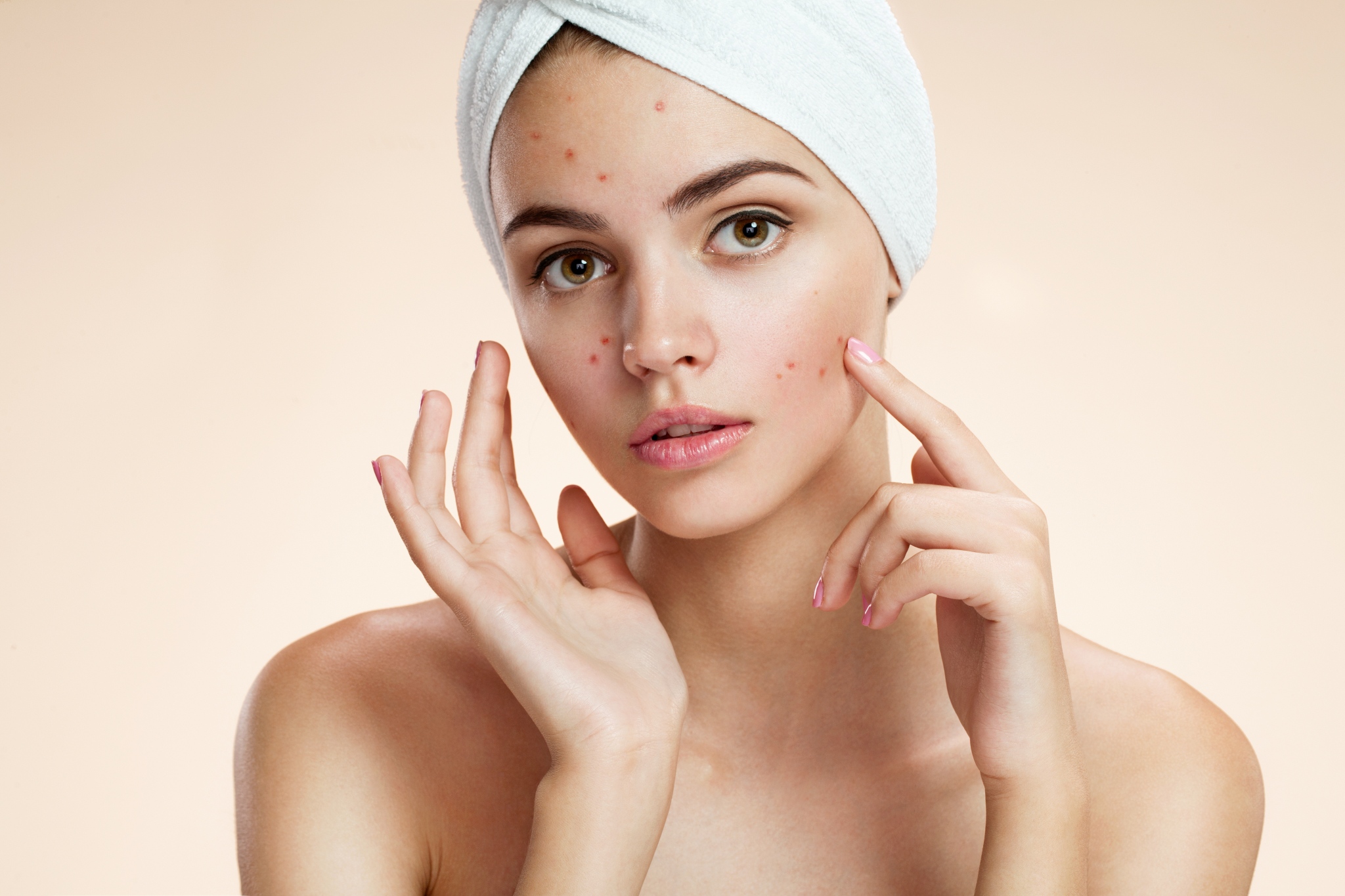 get-rid-of-acne-scars-the-best-products-for-you